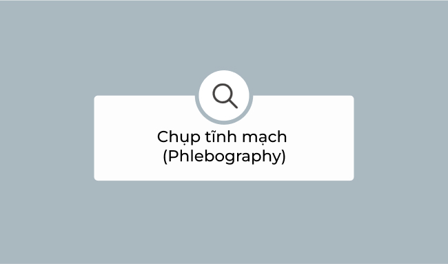 Chụp tĩnh mạch