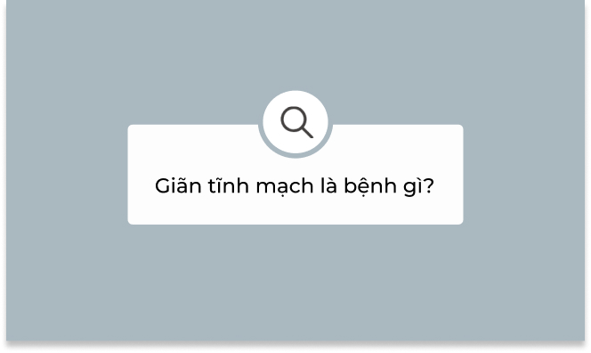 Giãn tĩnh mạch là gì? triệu chứng, chẩn đoán và điều trị